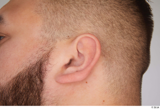 Ronaldo Biggato ear 0001.jpg